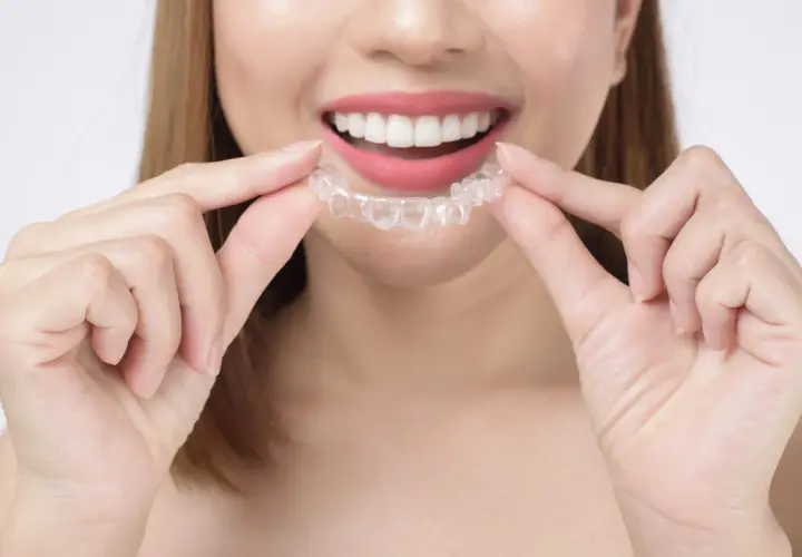 Sonrisa radiante con férula transparente de cera ortodoncia invisalign.