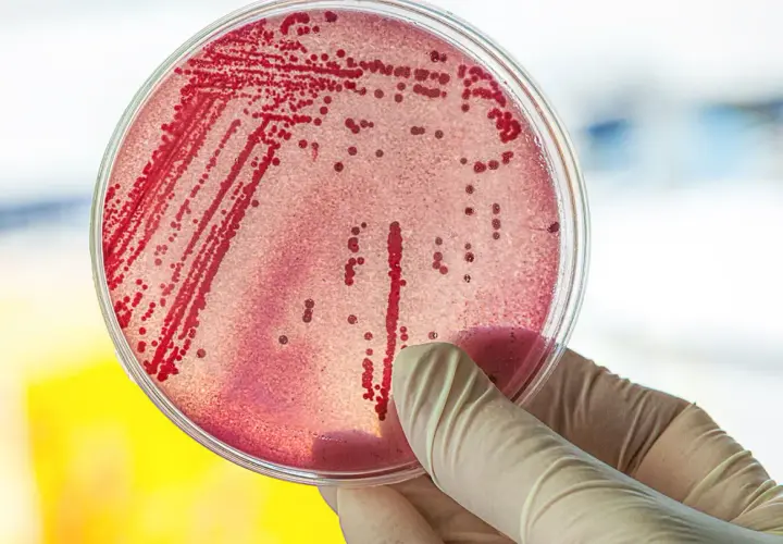 Symptome E. coli: Erkennen Sie die gefährlichen Anzeichen einer Infektion