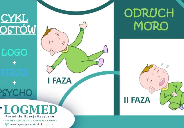 Ilustracja pokazuje dwie fazy odruchu Moro: pierwszą, gdy dziecko wyciąga ręce, i drugą, kiedy zanika odruch.