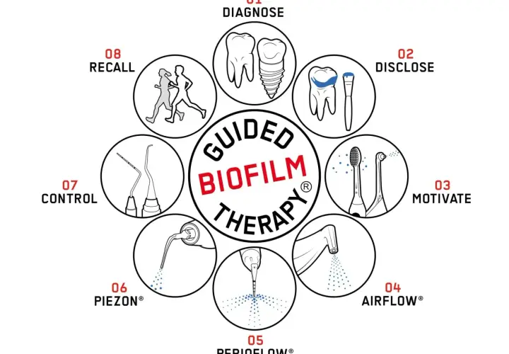 Schema della Guided Biofilm Therapy: diagnosi, rivelazione del biofilm batterico denti, motivazione, Airflow, Perioflow, Piezon, controllo e richiamo.