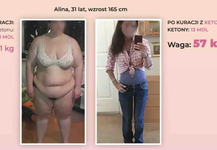 Przed i po kuracji Keto Black. Alina schudła 34 kg, co pokazuje, na czym polega dieta keto.