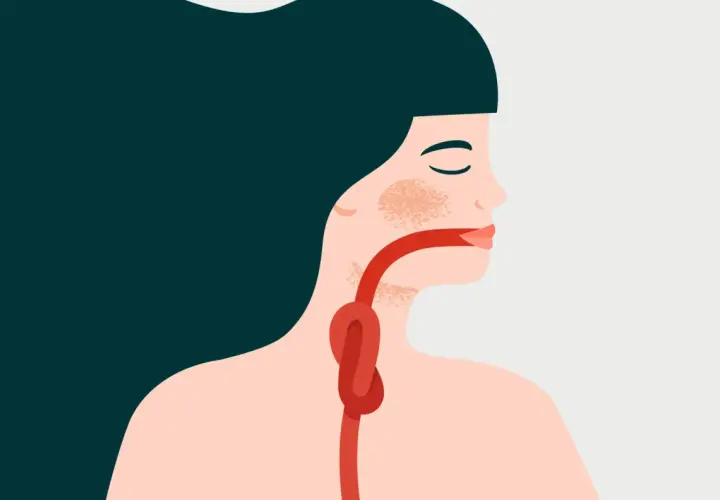Illustration d'une personne avec un nœud dans la gorge, symbolisant la difficulté à avaler sa salive.