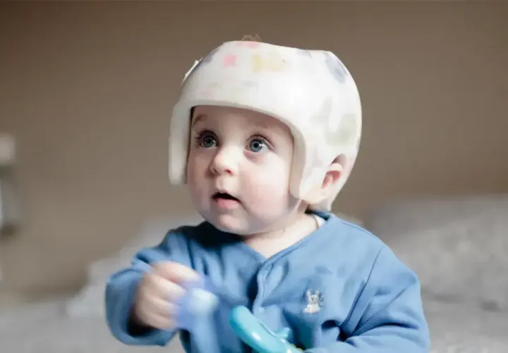Niebieskooki maluch w kolorowym kasku korekcyjnym z zabawką w ręku.