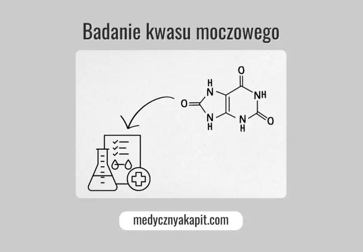 Badanie kwasu moczowego: schemat przedstawia jego wzór chemiczny i ikonografię symbolizującą analizę laboratoryjną.