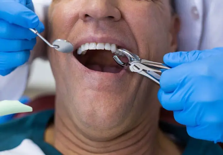 Dentista realiza extracción de muela infectada a paciente.