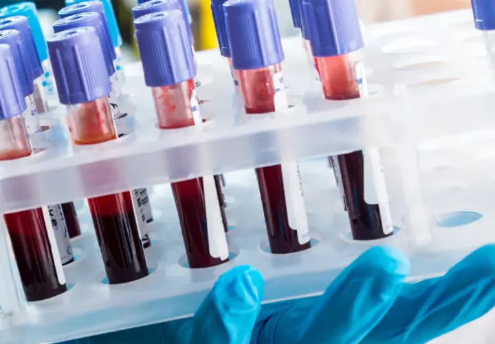 Diagnosta laboratoryjny i inni: Kto odpowiada za Twoje wyniki?