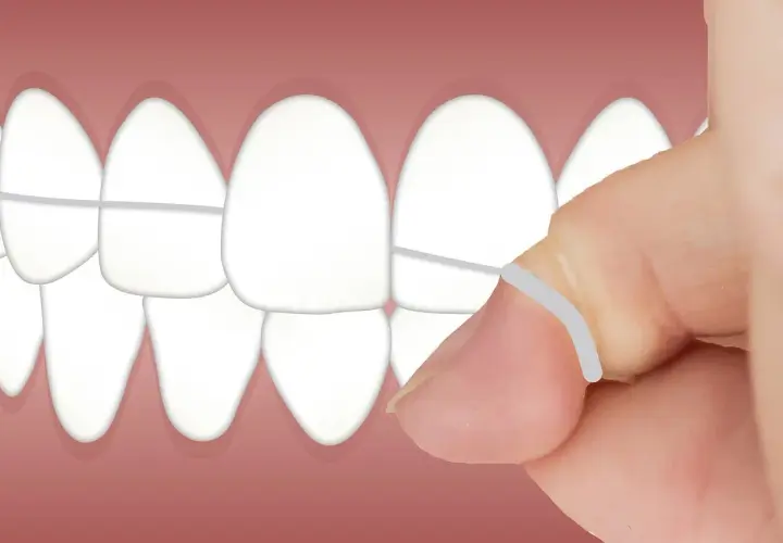 Dente pulito grazie al filo interdentale. Impara come usare il filo interdentale per una perfetta igiene orale.