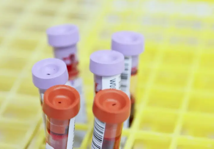 Krebsvorsorge Blutuntersuchung: Wie der PanTum Detect Test Leben retten kann