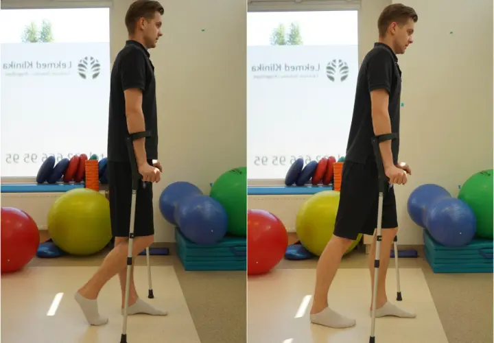 Jakie ćwiczenia po złamaniu kłykcia pomogą w szybszej rehabilitacji?