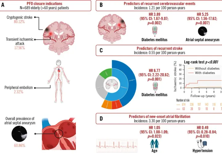 PFO closure indications: 80% kryptogenny udar, 17% TIA. Obraz przedstawia objawy neurologiczne i czynniki ryzyka udaru.