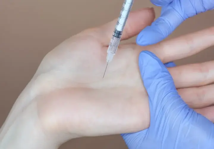 Jak skutecznie zapobiec poceniu się dłoni i odzyskać komfort