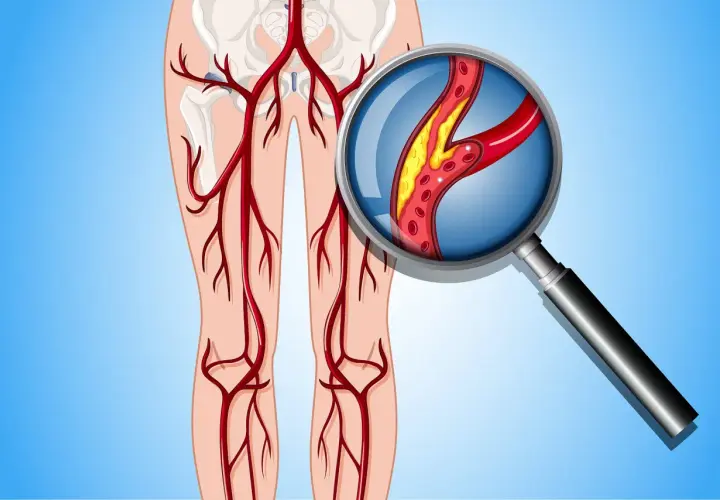 Wichtige Diagnosetechniken der peripheren arteriellen Verschlusskrankheit