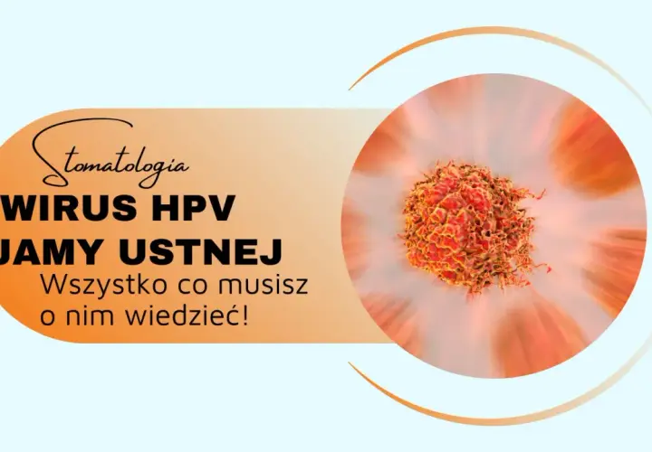 Wirus HPV w jamach ustnych może prowadzić do powstania brodawczaka. Dowiedz się więcej o tym zagrożeniu dla zdrowia jamy ustnej.