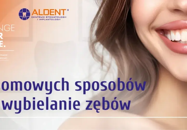 Jak wybielić zęby? Ekspert radzi: gabinet czy domowe sposoby?
