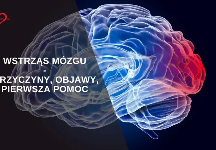 Wstrząśnienie mózgu objawy: co musisz wiedzieć o skutkach urazu głowy