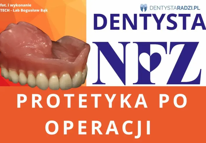 Gdzie zrobić protezę zębową na NFZ i uniknąć długiego czekania