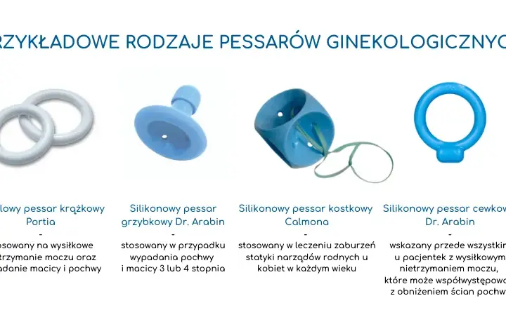 Pessar - jakie są koszty i zastosowanie w leczeniu ginekologicznym