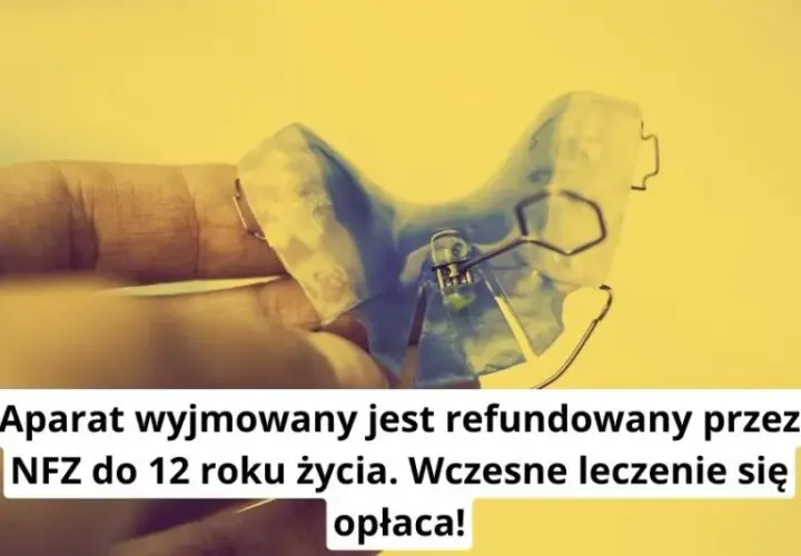Ile naprawdę kosztuje aparat ruchomy? Sprawdź, czy Cię na to stać!