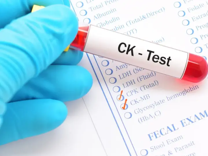 Ręka w niebieskiej rękawiczce trzyma probówkę z krwią do testu CK, czyli kinazy kreatynowej. Zaznaczono opcje CPK (Total) i CK-MB.