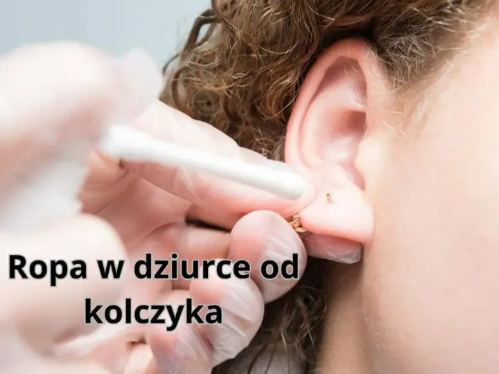 Ropa w dziurce od kolczyka. Wacik kosmetyczny usuwa wydzielinę z ucha po przekłuciu.