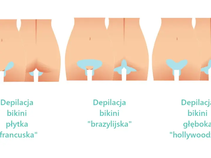 Depilacja bikini głębokiego: Co obejmuje? Różnice i efekty