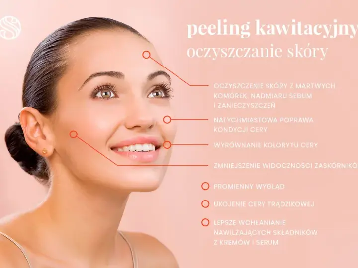 Kobieta z promienną cerą po zabiegach oczyszczających na twarz. Peeling kawitacyjny usuwa martwy naskórek i zanieczyszczenia.
