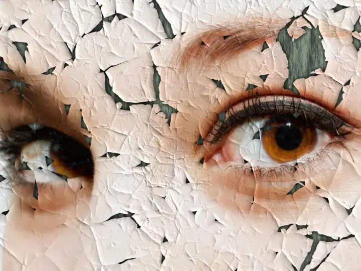 Nahaufnahme von Augen mit rissiger, trockener Haut.