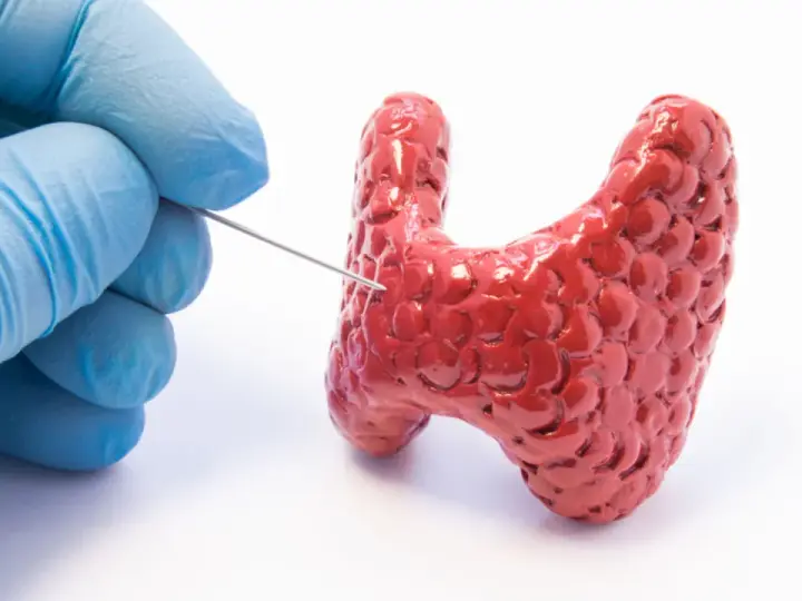 Ręka w niebieskiej rękawiczce wykonuje biopsję tarczycy, pobierając próbkę z czerwonego modelu gruczołu.