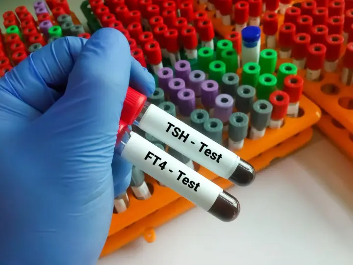 Ręka w niebieskiej rękawiczce trzyma probówki z oznaczeniami TSH i FT4 - Test. To kluczowe badania do oceny funkcji tarczycy.