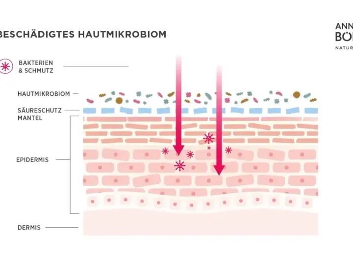 Illustration zeigt ein geschädigtes Hautmikrobiom mit Bakterien und Schmutz, die in die Epidermis eindringen.