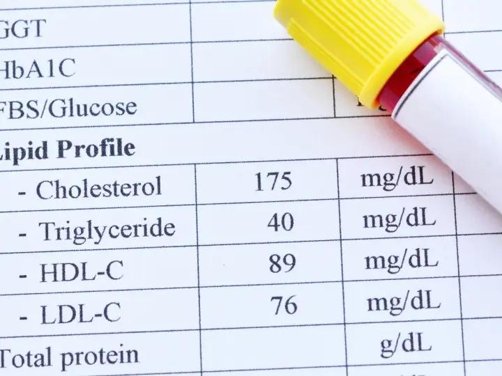 Wynik lipidogramu: cholesterol 175, trójglicerydy 40, HDL-C 89, LDL-C 76 mg/dL. To badanie ocenia profil lipidowy.