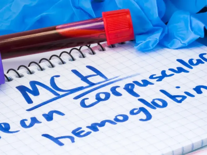 Probówka z krwią, notatnik z napisem "MCH mean corpuscular hemoglobin" i rękawiczki medyczne.