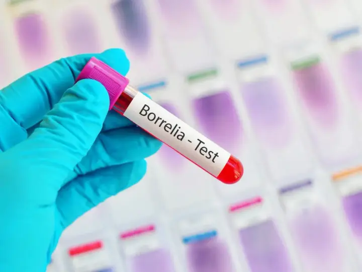 Ręka w niebieskiej rękawiczce trzyma probówkę z napisem "Borrelia - Test". To klucz do odpowiedzi, gdzie zrobić badania na boreliozę.