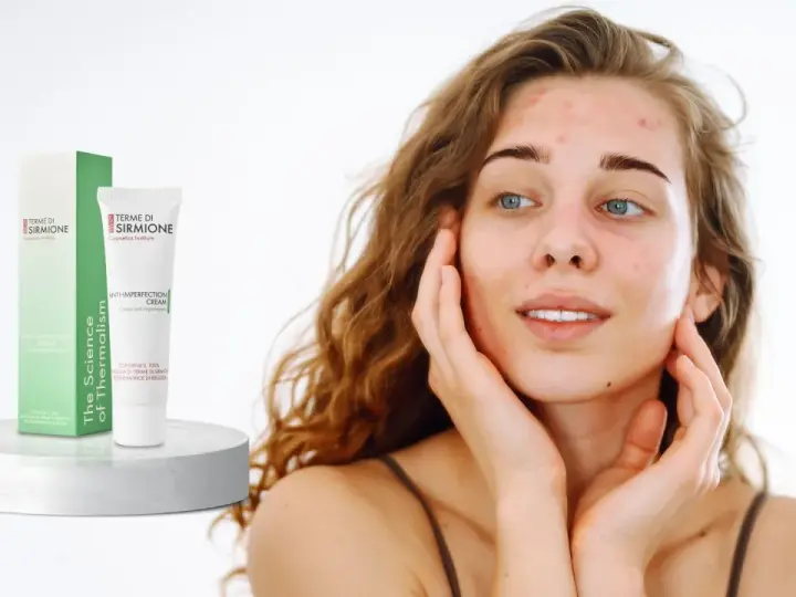 Giovane donna con acne pelle, accarezza il viso vicino a una crema anti-imperfezione Terme di Sirmione.