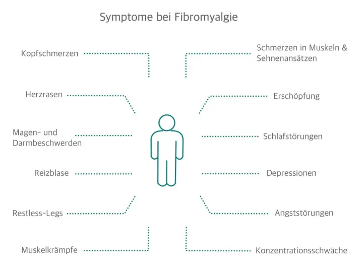 Schema mit menschlicher Figur und umgebenden Symptomen von Fibromyalgie wie Kopfschmerzen, Erschöpfung.
