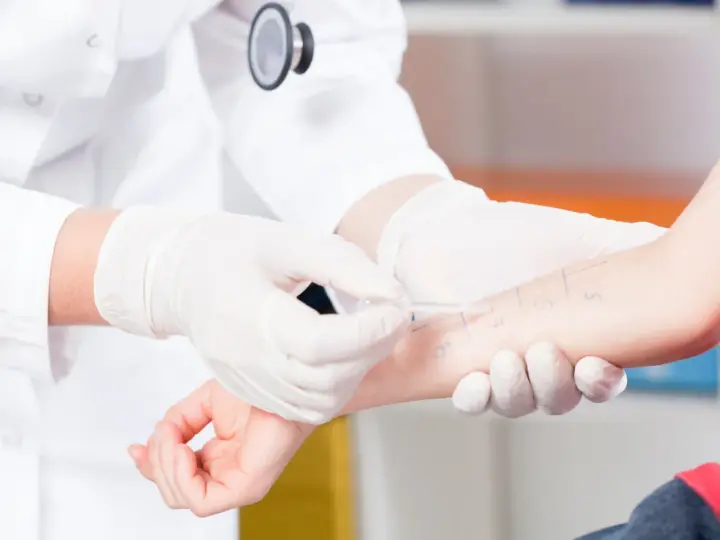 Lekarz w białej rękawiczce wykonuje test skórny na ramieniu pacjenta.