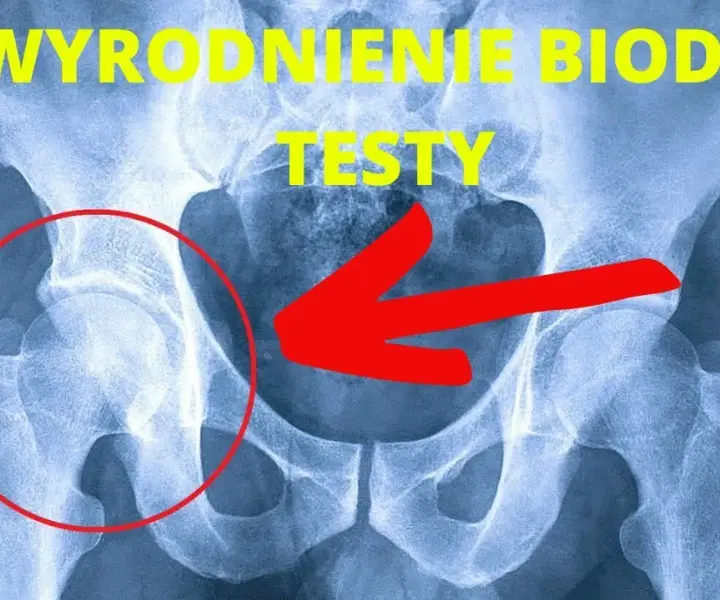 Odkryj tajniki Totalna Biologia Biodro i zwalczyj ból biodra efektywnie