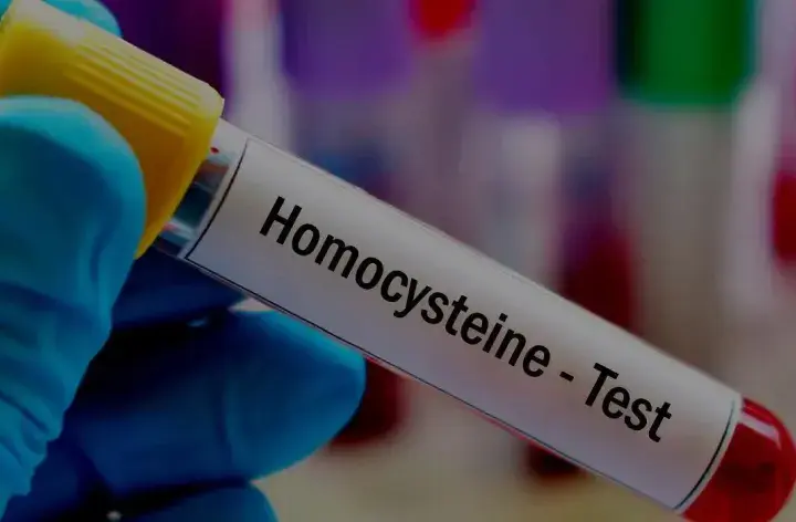 Ile kosztuje badanie homocysteina? Sprawdź ceny i oszczędź pieniądze