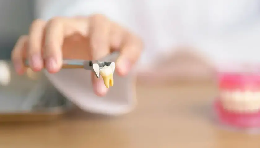 Un dente estratto con pinze, un monito per chi teme di rimanere senza denti a 40 anni.