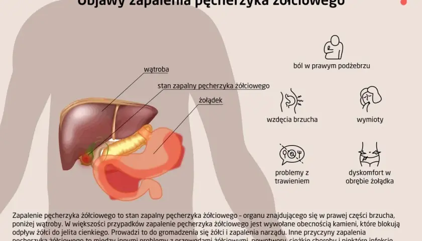 Anatomia jamy brzusznej z zaznaczonym zapaleniem pęcherzyka żółciowego. Objawy: ból, wzdęcia, wymioty, problemy z trawieniem.