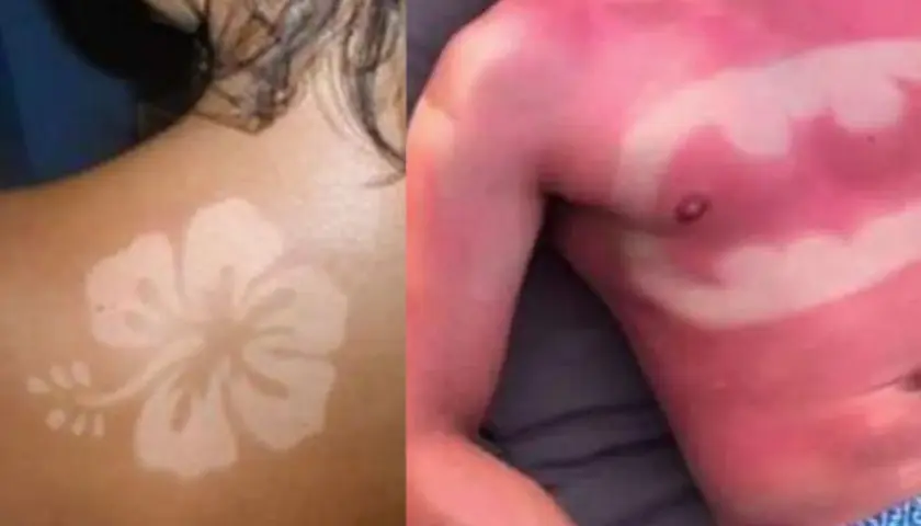 Un coup de soleil révèle un tatouage en forme de fleur d'hibiscus sur une épaule. Sur la droite, un autre coup de soleil dessine le symbole de Batman sur un torse.
