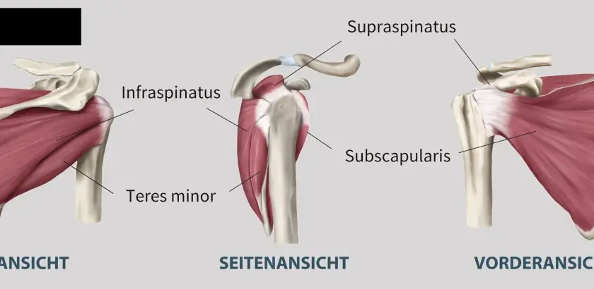 Schulteransichten: Rück-, Seiten- und Vorderansicht zeigen Muskeln wie Infraspinatus, Subscapularis und Teres minor. Bei Schmerzen im Teres minor ist eine genaue Diagnose wichtig.