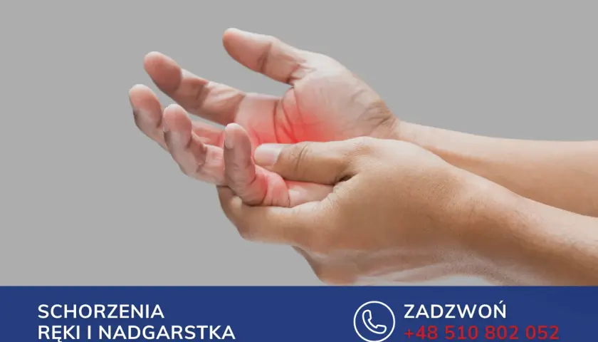 Dłoń z zaczerwienieniem na palcu, wskazującym na zapalenie pochewki ścięgna zginacza palca. Leczenie schorzeń ręki i nadgarstka.