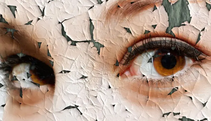 Nahaufnahme von Augen mit rissiger, trockener Hauttextur.