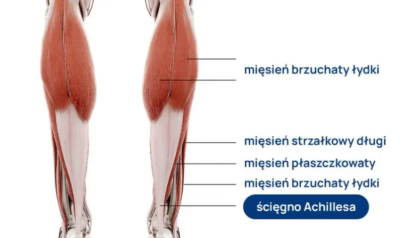 Uczucie miękkich nóg przyczyny – co może prowadzić do osłabienia mięśni?