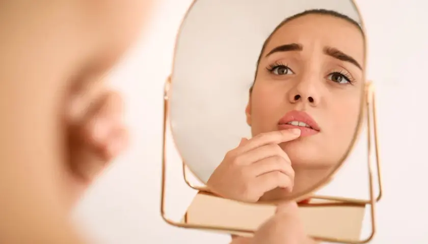 Ragazza preoccupata si guarda allo specchio, toccandosi le labbra screpolate, segno di afte da stress.