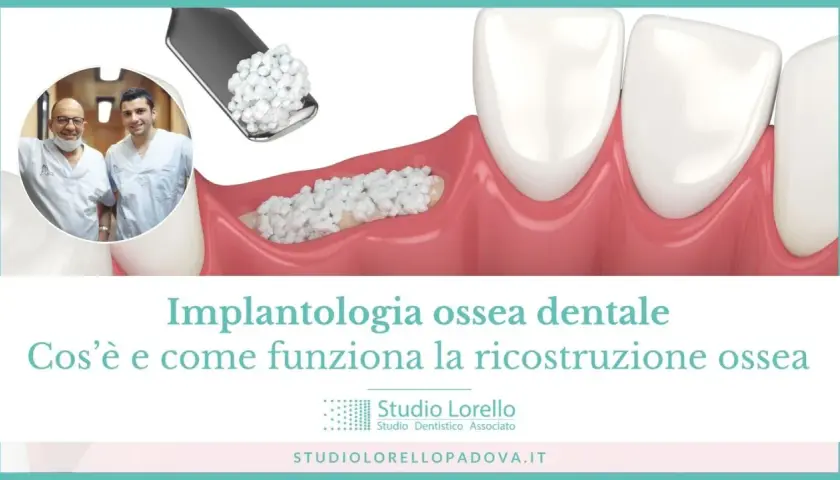 Ricostruzione ossea per implantologia dentale: due dentisti sorridono mentre un'immagine mostra il materiale per l'innesto osseo.