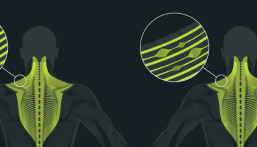 Illustration anatomique montrant des points de tension musculaire, avec un zoom sur des fibres tendues. La traduction de "trigger point" est ici illustrée.