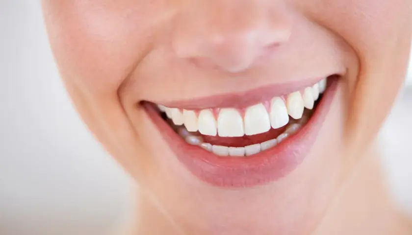 Sorriso smagliante con denti bianchi e perfetti, un vero spettacolo **male al dente** non è un problema qui.