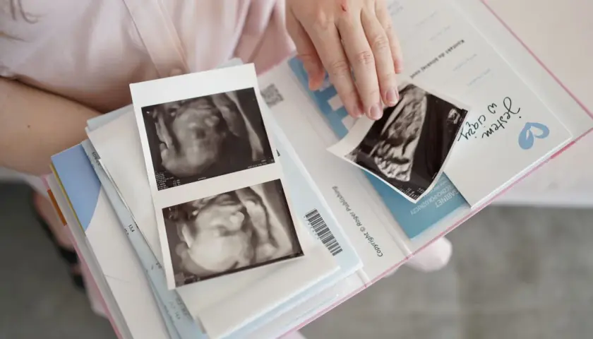 Uśmiechnięta przyszła mama przegląda zdjęcia USG. To piękny czas tycia w ciąży, jak na Mamaginekolog.
